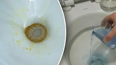 Žluté skvrny zmizí okamžitě: stačí nalít tento domácí prostředek do toalety